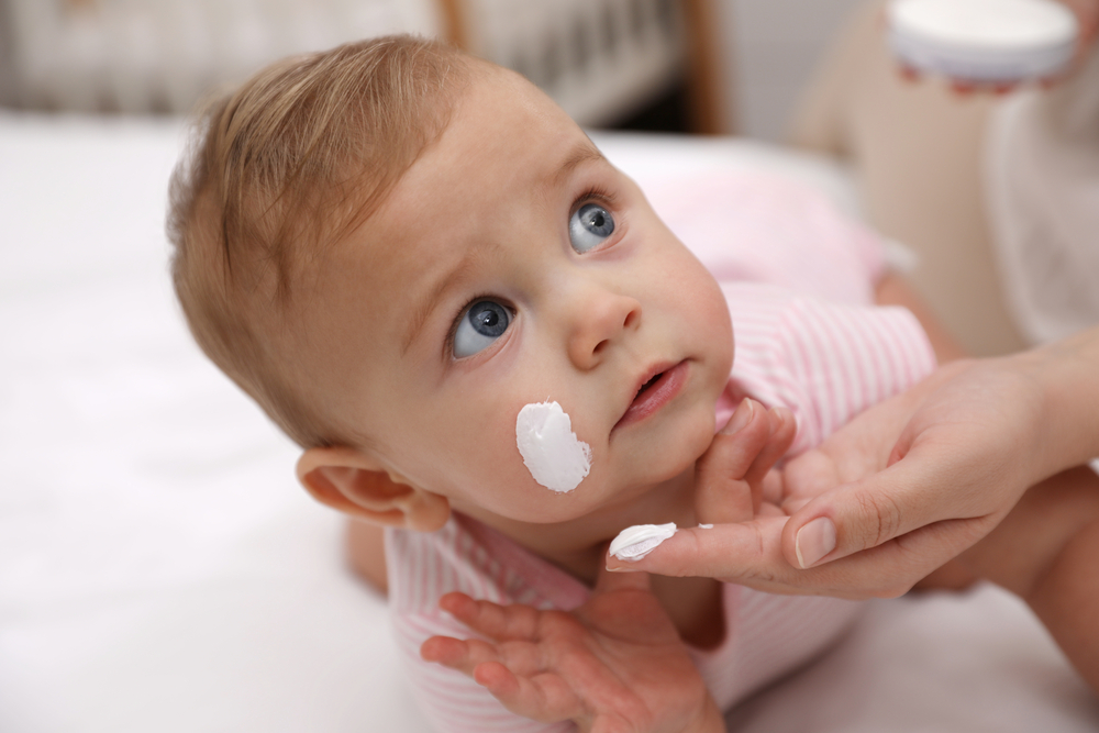 Migliore crema doposole neonati: proteggi e lenisci la pelle delicata del  tuo bambino 